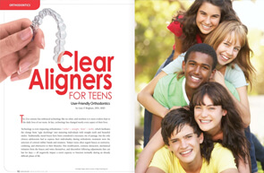 Clear Aligners - Dear Doctor Magazine