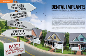 Dental Implants - Dear Doctor Magazine