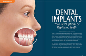 Dental Implants - Dear Doctor Magazine