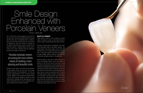 Porcelain Veneers - Dear Doctor Magazine