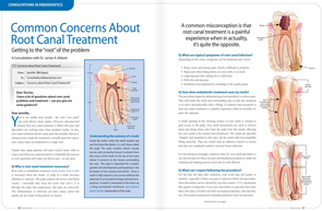 Common Root Canal Concerns - Dear Doctor Magazine