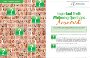 Teeth Whitening - Dear Doctor Magazine