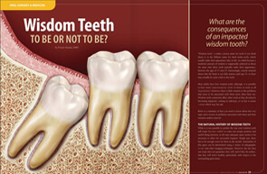 Wisdom Teeth – Dear Doctor Magazine